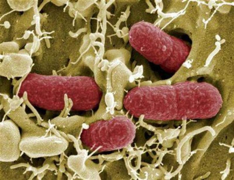 FUENTE DEL BROTE DE E. COLI PODRÍAN DEVENIR DE SEMILLAS EGIPCIAS